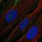 CD13 antibody, NBP2-33855, Novus Biologicals, Immunocytochemistry image 