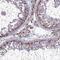 Proteasome 26S Subunit, Non-ATPase 11 antibody, HPA042275, Atlas Antibodies, Immunohistochemistry frozen image 