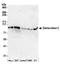Segment polarity protein dishevelled homolog DVL-2 antibody, A302-952A, Bethyl Labs, Western Blot image 
