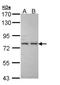 Insulin Like Growth Factor Binding Protein Acid Labile Subunit antibody, NBP1-32874, Novus Biologicals, Western Blot image 