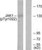 Janus Kinase 1 antibody, TA314109, Origene, Western Blot image 