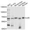 Lipolysis-stimulated lipoprotein receptor antibody, A9340, ABclonal Technology, Western Blot image 