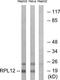 Ribosomal Protein L12 antibody, TA314459, Origene, Western Blot image 