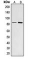 Cyclic Nucleotide Gated Channel Alpha 2 antibody, LS-C352020, Lifespan Biosciences, Western Blot image 
