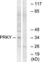 Serine/threonine-protein kinase PRKY antibody, TA311845, Origene, Western Blot image 