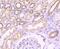 Fibroblast Growth Factor Receptor 3 antibody, NBP2-66839, Novus Biologicals, Immunohistochemistry paraffin image 