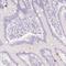 LON Peptidase N-Terminal Domain And Ring Finger 3 antibody, NBP2-47391, Novus Biologicals, Immunohistochemistry paraffin image 