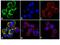 c-met antibody, 701760, Invitrogen Antibodies, Immunofluorescence image 