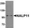 NLR Family Pyrin Domain Containing 11 antibody, A13671, Boster Biological Technology, Western Blot image 