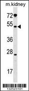 Polypeptide N-Acetylgalactosaminyltransferase 13 antibody, 59-717, ProSci, Western Blot image 