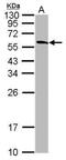 Tripartite Motif Containing 72 antibody, PA5-31233, Invitrogen Antibodies, Western Blot image 