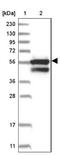 USH1 Protein Network Component Harmonin antibody, NBP1-89189, Novus Biologicals, Western Blot image 