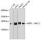 ATP Binding Cassette Subfamily C Member 1 antibody, GTX33323, GeneTex, Western Blot image 