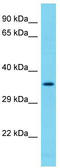 NADH:Ubiquinone Oxidoreductase Complex Assembly Factor 7 antibody, TA330685, Origene, Western Blot image 