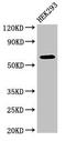 DEP Domain Containing 1B antibody, CSB-PA851968LA01HU, Cusabio, Western Blot image 
