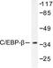 CCAAT Enhancer Binding Protein Beta antibody, LS-C175940, Lifespan Biosciences, Western Blot image 