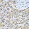 G Elongation Factor Mitochondrial 1 antibody, LS-C333825, Lifespan Biosciences, Immunohistochemistry paraffin image 