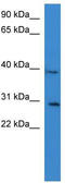 Collagen Like Tail Subunit Of Asymmetric Acetylcholinesterase antibody, TA337936, Origene, Western Blot image 