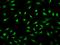 MYCL Proto-Oncogene, BHLH Transcription Factor antibody, 207319-T02, Sino Biological, Immunohistochemistry frozen image 