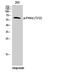 P21 (RAC1) Activated Kinase 1 antibody, A00454T212-1, Boster Biological Technology, Western Blot image 