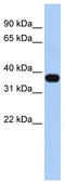 Mitochondrial E3 Ubiquitin Protein Ligase 1 antibody, TA330466, Origene, Western Blot image 