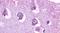 5-Hydroxytryptamine Receptor 5A antibody, PA5-33312, Invitrogen Antibodies, Immunohistochemistry paraffin image 