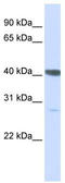 DnaJ Heat Shock Protein Family (Hsp40) Member B11 antibody, TA342009, Origene, Western Blot image 