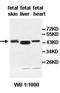 Acyl-CoA Thioesterase 1 antibody, orb77670, Biorbyt, Western Blot image 