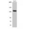 Sca2 antibody, LS-C382160, Lifespan Biosciences, Western Blot image 