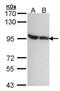 DEAD-Box Helicase 1 antibody, GTX105205, GeneTex, Western Blot image 