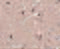 Zinc Finger Protein 667 antibody, 5219, ProSci, Immunohistochemistry paraffin image 