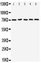 PD-L1 antibody, PA1851, Boster Biological Technology, Western Blot image 