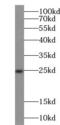 Hypoxanthine-guanine phosphoribosyltransferase antibody, FNab03997, FineTest, Western Blot image 