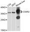 Complement Component 5a Receptor 2 antibody, STJ112602, St John