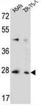 Transmembrane 4 L Six Family Member 4 antibody, AP54133PU-N, Origene, Western Blot image 