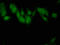 Solute Carrier Family 2 Member 4 antibody, LS-C370357, Lifespan Biosciences, Immunofluorescence image 