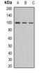Actinin Alpha 1 antibody, orb339023, Biorbyt, Western Blot image 