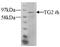Transglutaminase 2 antibody, AP10441PU-N, Origene, Western Blot image 