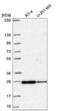 Ras-related protein Rab-11B antibody, NBP2-58127, Novus Biologicals, Western Blot image 
