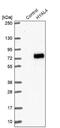 Hyaluronidase 4 antibody, NBP1-86355, Novus Biologicals, Western Blot image 
