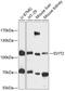 Extended Synaptotagmin 2 antibody, 14-651, ProSci, Western Blot image 