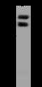 1-phosphatidylinositol-3-phosphate 5-kinase antibody, 205711-T44, Sino Biological, Western Blot image 