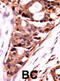Serine/threonine-protein phosphatase 2B catalytic subunit beta isoform antibody, abx033965, Abbexa, Immunohistochemistry paraffin image 