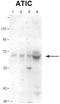 Bifunctional purine biosynthesis protein PURH antibody, TA339263, Origene, Western Blot image 
