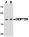 DEP Domain Containing MTOR Interacting Protein antibody, A03811, Boster Biological Technology, Western Blot image 