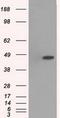 Mitogen-activated protein kinase 12 antibody, GTX84148, GeneTex, Western Blot image 