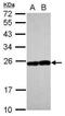 RAB17, Member RAS Oncogene Family antibody, PA5-31035, Invitrogen Antibodies, Western Blot image 