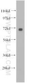 SEC61A1 antibody, 15512-1-AP, Proteintech Group, Western Blot image 