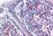 Vasodilator Stimulated Phosphoprotein antibody, MBS247476, MyBioSource, Immunohistochemistry paraffin image 