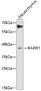 Harbinger Transposase Derived 1 antibody, 14-676, ProSci, Western Blot image 